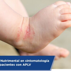 Abordaje Nutrimental en sintomatología grave de pacientes con APLV (infographics)