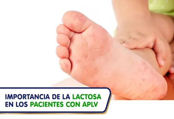 Importancia de la lactosa en los pacientes con APLV (infographics)