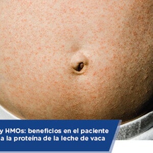 Microbiota y HMOs: beneficios en el paciente con alergia a la proteína de la leche de vaca (infographics)